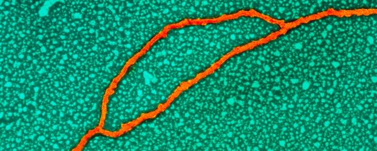 Тепер ви можете дізнатися, якщо ваша ДНК піддає вас більшому ризику захворювань
