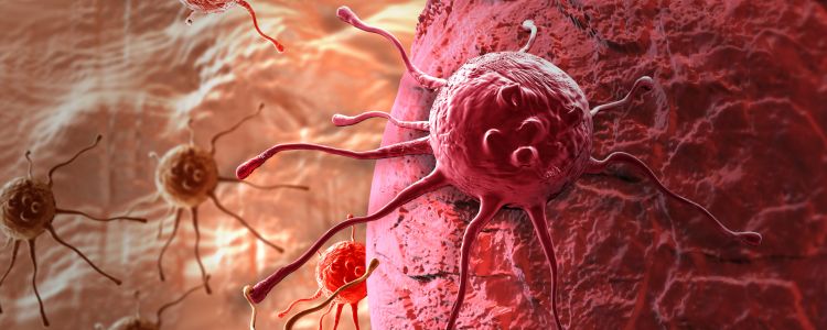 Новий метод лікування знищив ракову пухлину молочної залози протягом 11 днів без хімії