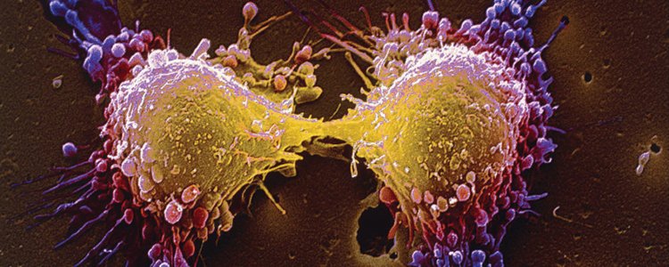 Зміна властивостей ДНК: у вчених є новий спосіб боротьби з раком