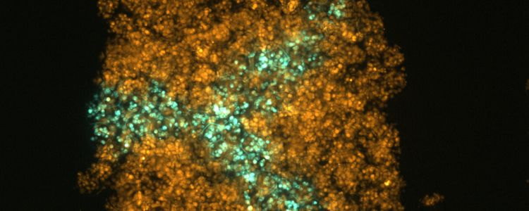 Вчені розробили новий метод для 3D-друку живої тканини