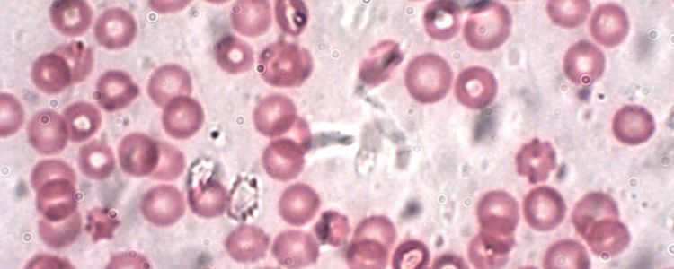 Новий паперовий тест може визначити ваш тип крові всього за 30 секунд