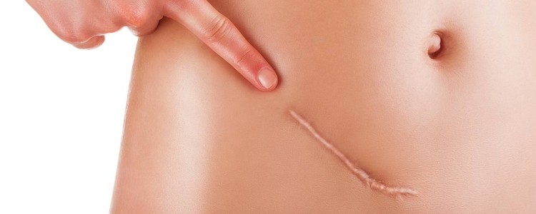 Кінець рубцям: вчені з'ясували, як відновити людську шкіру