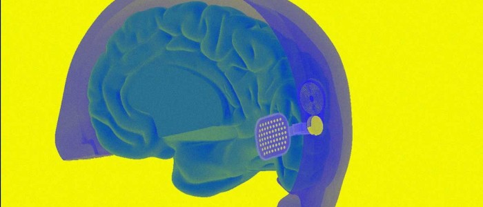 Біонічне око дозволяє бачити чоловіку, що осліп після нещасного випадку