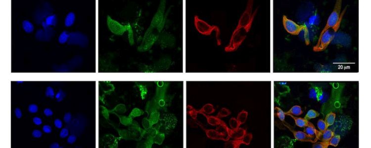 Дослідники розробляють нову протиракову вакцину за допомогою вірусоподібних часток