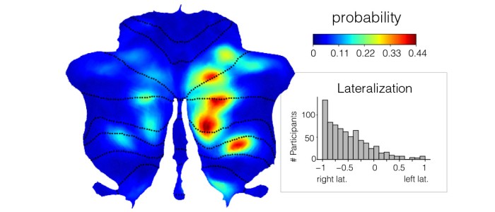 В головному мозку є ділянка, яка відповідає за любов до мови