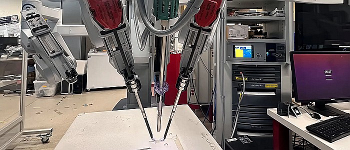 Хірургічний робот, керований ШІ, видалив жовчний міхур зі "100% точністю"