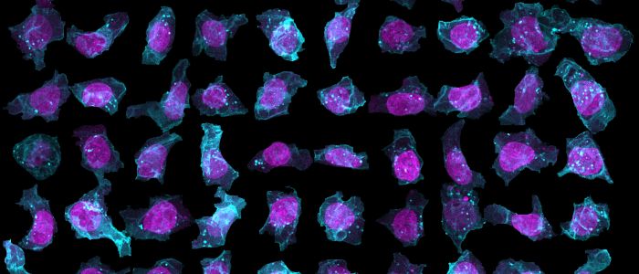Штучний інтелект створив повну 3Д модель зміни клітин хворобою