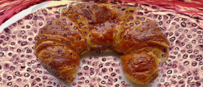 Алгоритм тренований на випічці відмінно допомагає виявляти рак