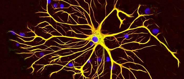 Вчені виявили систему очищення мозку, яка руйнується при хворобі Альцгеймера