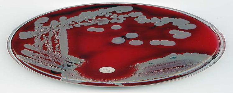 Стійкість до антибіотиків зробила ще один небезпечний «стрибок» між видами