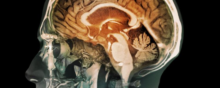 Цей препарат може відремонтувати пошкодження мозку у жертв інсульту