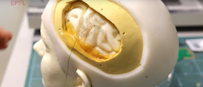 Мозковий монітор входить в отвір у черепі та розгортає електроди у формі квітки