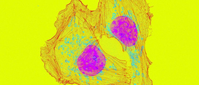 Симптоми раку можуть з'явитися за роки до постановки діагнозу