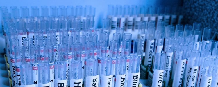 Проривний тест раку визначає, яке з 15 лікарств найбільш ймовірно зможе викорінити пухлину