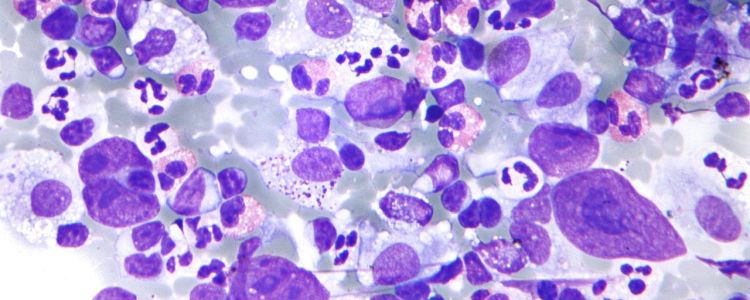 Ракова «вакцина», яка знищує пухлини, готова до випробування на людях