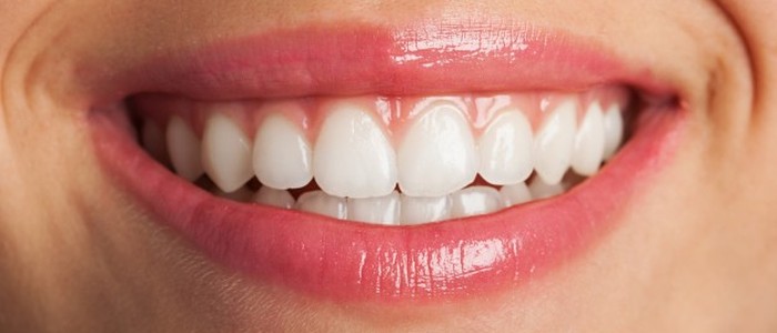 Знаменитості назавжди псують свої зуби заради «ідеальної посмішки»