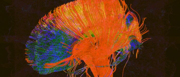 Хіміки виростили «синтетичний мозок», який зберігає спогади в сріблі