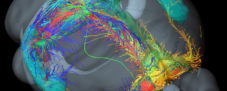 Нове лікування хвороби Альцгеймера може остановити дегенерацію синапсів і втрату пам'яті 