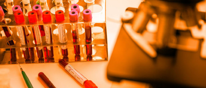 Ця вакцина проти ковід-19 може бути готова до вересня