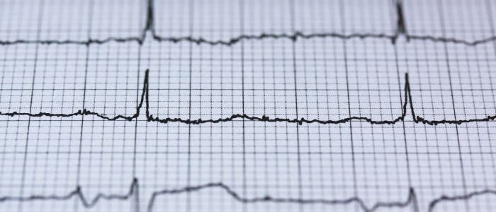 Стоматологи тепер стежать за стресовими навантаженнями пацієнтів