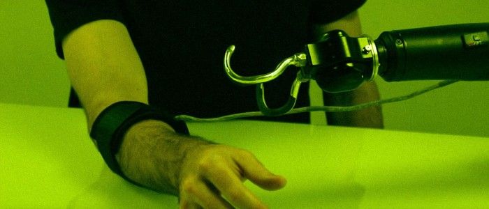 Лікарі використовують ШІ і ВР для поліпшення протезів