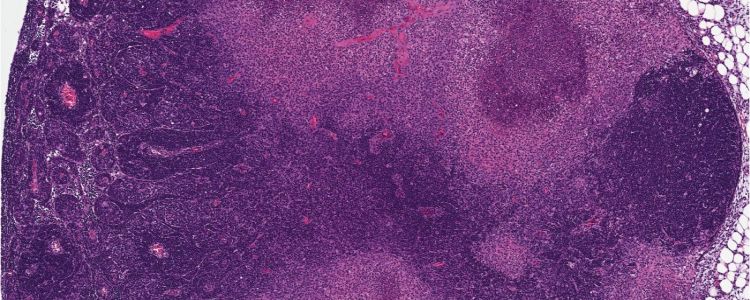 Вмираючі клітини можуть попередити своїх сусідів в спробі запобігти зараженню