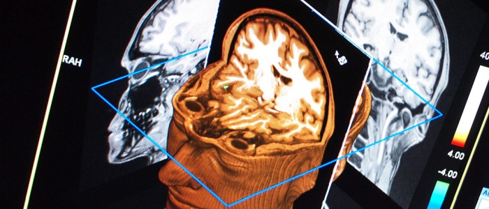 Еволюція могла обмежити розмір людського мозку, щоб збалансувати енергетичні витрати