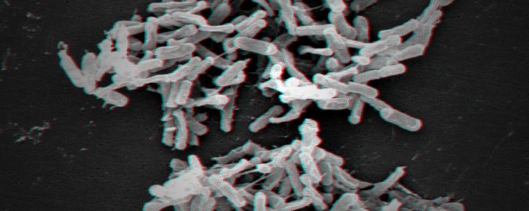 Нарешті, штучний інтелект робить щось корисне: бореться з лікарняними інфекціями