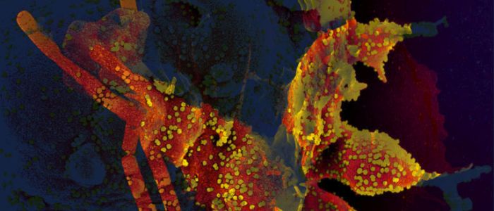 Хороша новина: людський організм виробляє «стійку» імунну відповідь на коронавірус