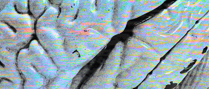 Алгоритм IBM може визначити за письмом, чи захворіє людина на хворобу Альцгеймера