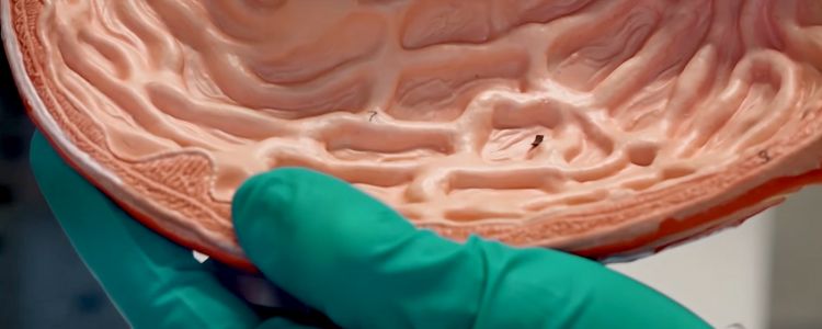 Неймовірно рухливий «мінімалістський робот» може стати майбутнім неінвазивної медицини