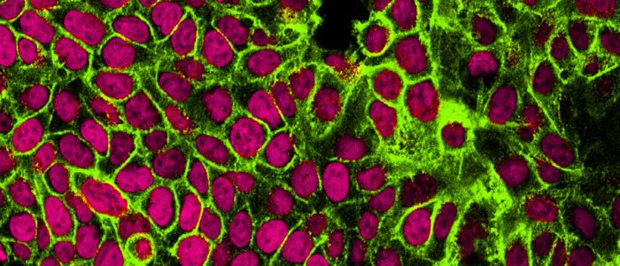 Ізраїльські вчені впевнені, що матимуть ліки проти раку протягом року 