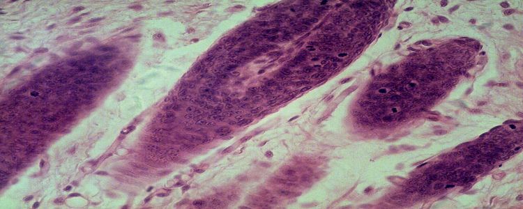 Вирощена в лабораторії шкіра з волоссям обіцяє лікування захворювань шкіри