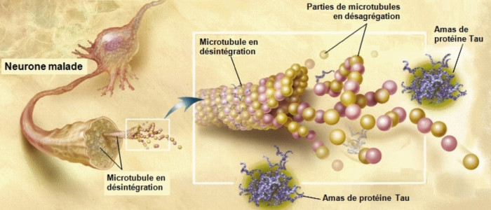 Вчені, можливо, виявили причину хвороби Альцгеймера на молекулярному рівні