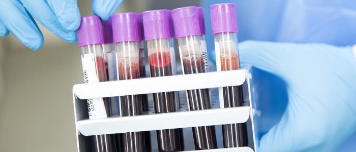 Новий аналіз крові виявляє рак за багато років до появи симптомів