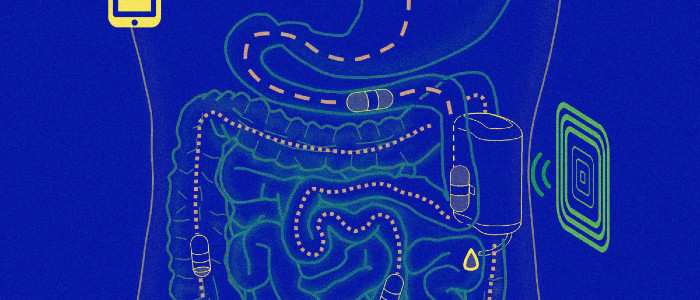 Нове лікування діабету має робота, «закріпленого» всередині вашого кишечника