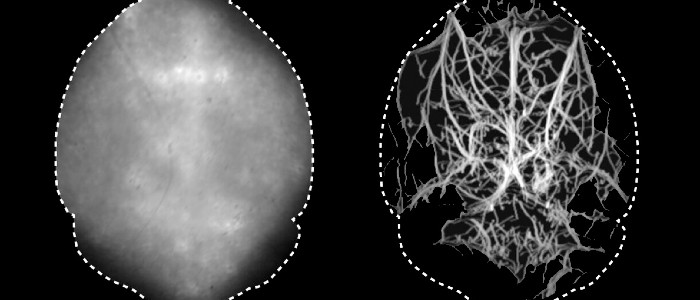 Нова техніка мікроскопії дозволяє заглядати в мозок без хірургічного втручання