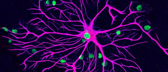 Нове дослідження може зупинити розсіяний склероз