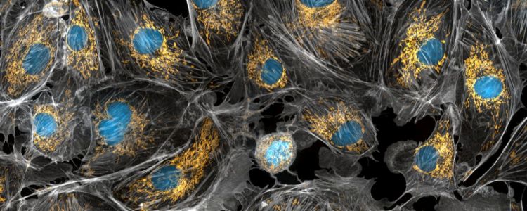 Нове дослідження показує, як мітохондрії страждають від хвороби