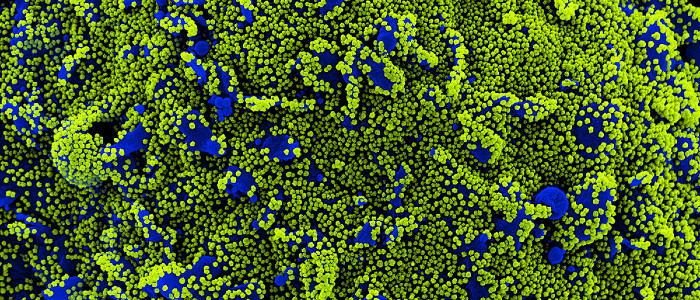 Попередні дослідження пояснюють, чому варіант дельта такий небезпечний