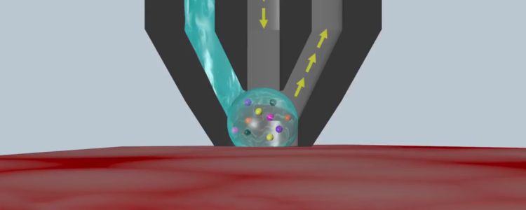 Дослідники створили хірургічний пристрій, який може ідентифікувати ракові клітини за секунди