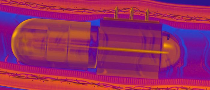 Робо-пігулка проколює стінки кишечника для доставлення ліків