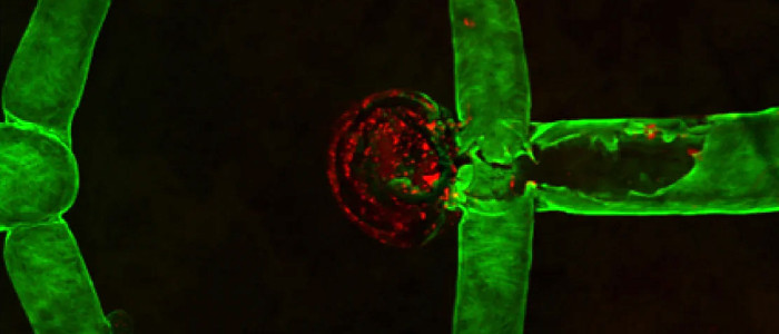 Вчені створили першу у світі "живу" аневризму мозку людини