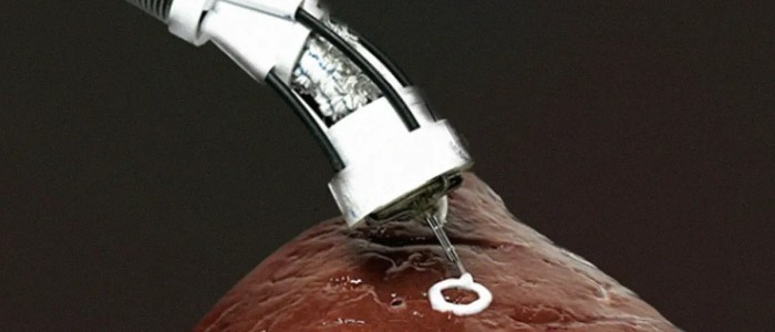 Вчені розробили спосіб 3D-друку всередині людського тіла