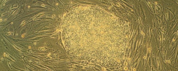 Вчені вперше виростили робочий людський м'яз зі стовбурових клітин