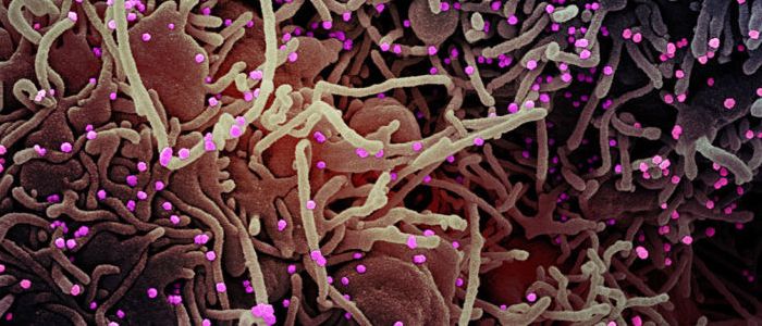 У вчених з'явилася багатообіцяюча ідея як перемогти коронавірус