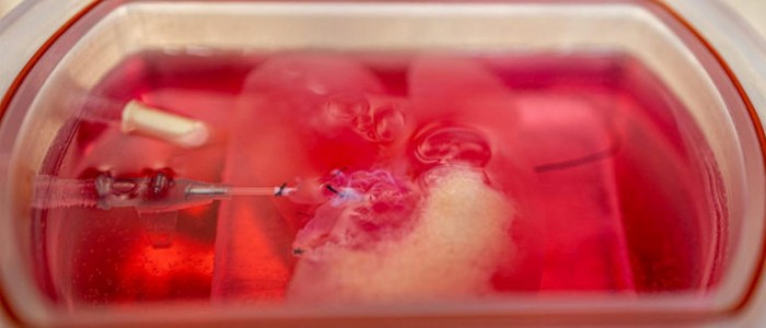 Вчені надрукували функціональні людські «міні-печінки»