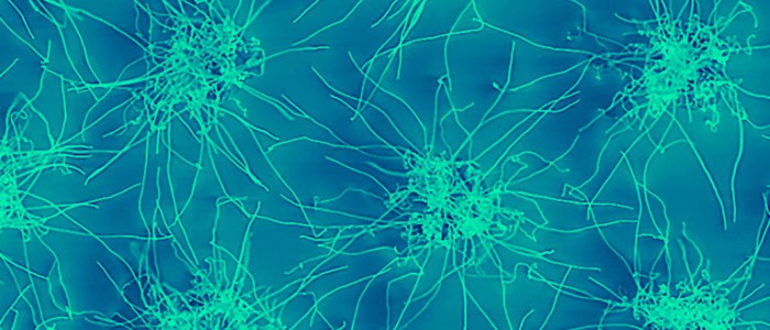 Крихітні срібні дроти демонструють «мозкоподібні» властивості