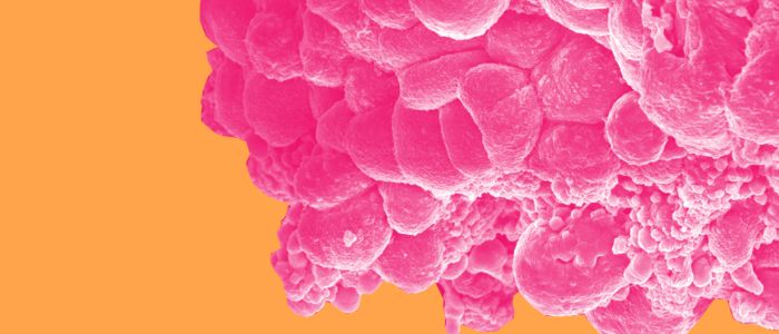 Деякі пацієнти з раком молочної залози можуть відмовитись від хіміотерапії