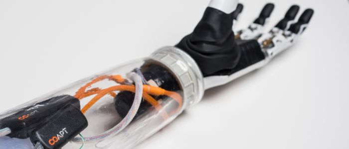 Новітні протези отримують накази прямо з ваших нервів